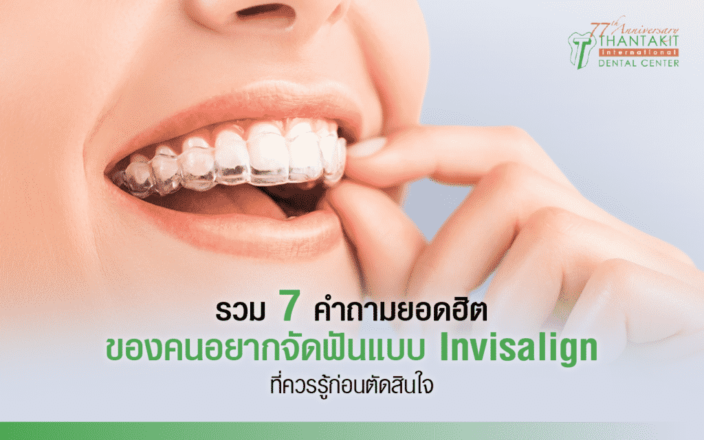 จัดฟันแบบ Invisalign