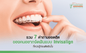 จัดฟันแบบ Invisalign