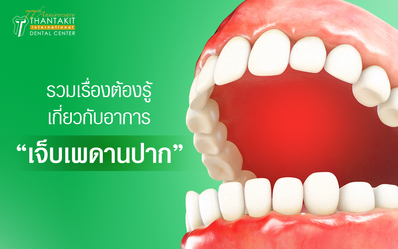 อาการ เจ็บเพดานปาก เกิดจากอะไร มีวิธีป้องกันอย่างไร อาการ เจ็บเพดานปาก เกิดจากอะไร มีวิธีป้องกันอย่างไร