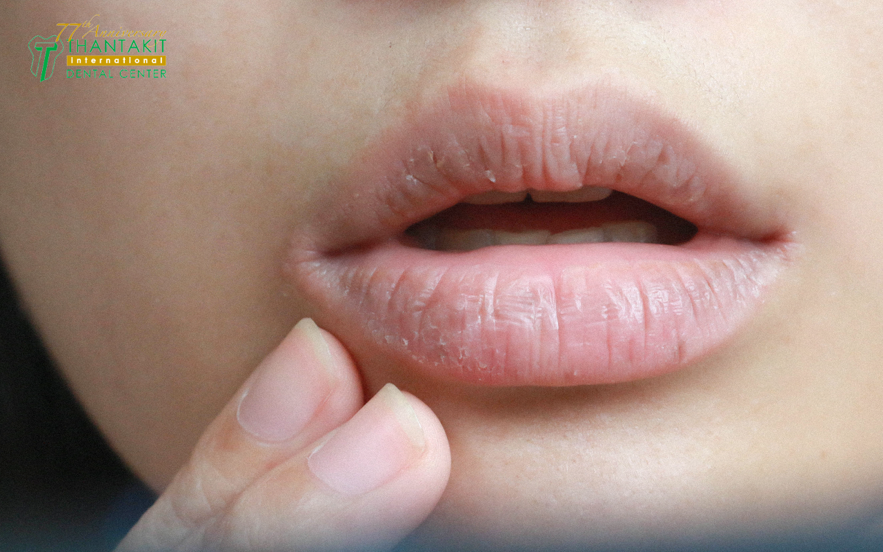 “น้ำลายเหนียว” อาจเป็นสัญญาณเตือนสุขภาพได้ ศูนย์ทันตกรรมทันตกิจ