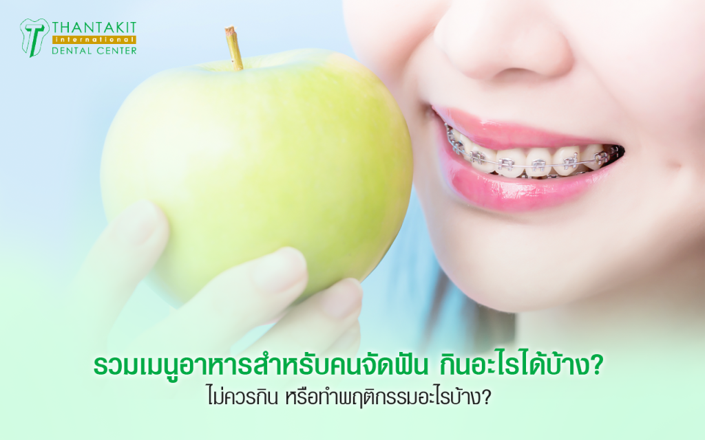 อาหารสำหรับคนจัดฟัน