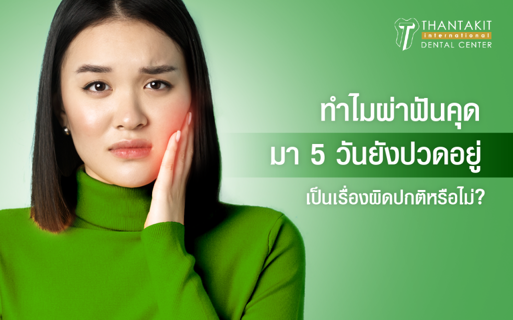 ผ้าฟันคุดมา 5 วัน ยังปวดอยู่