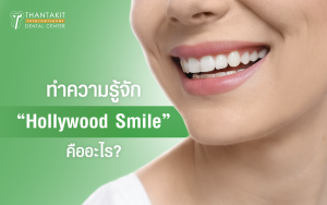 Hollywood Smile