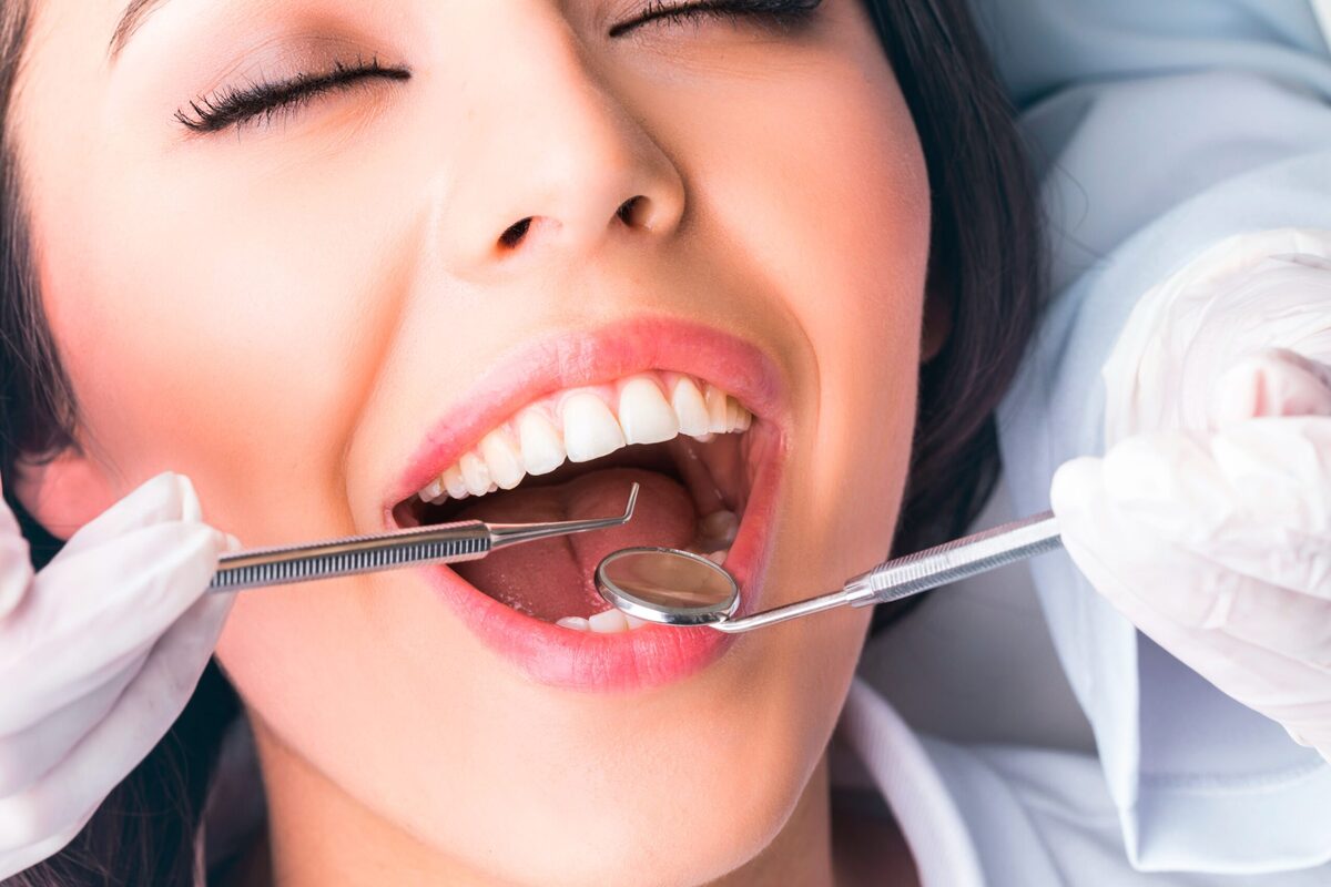 DIY Tooth Bonding @ home dental care. Save Money! 