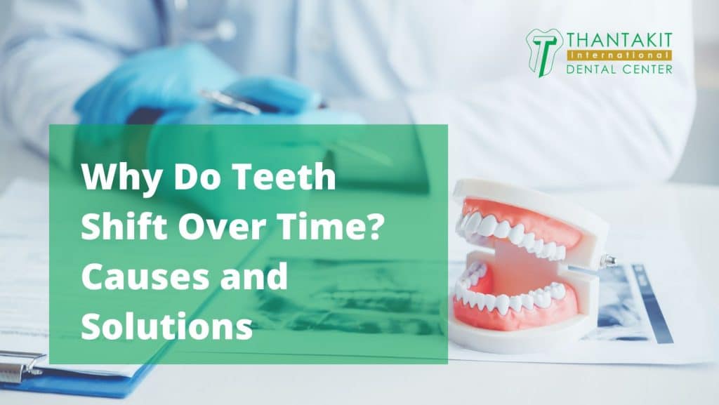 Why Do Teeth Shift Over Time Causes and Solutions