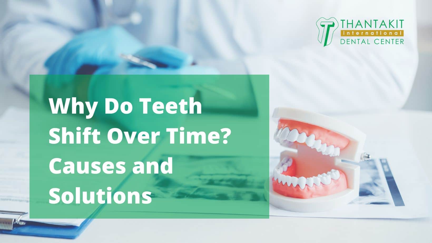 Why Do Teeth Shift Over Time Causes and Solutions