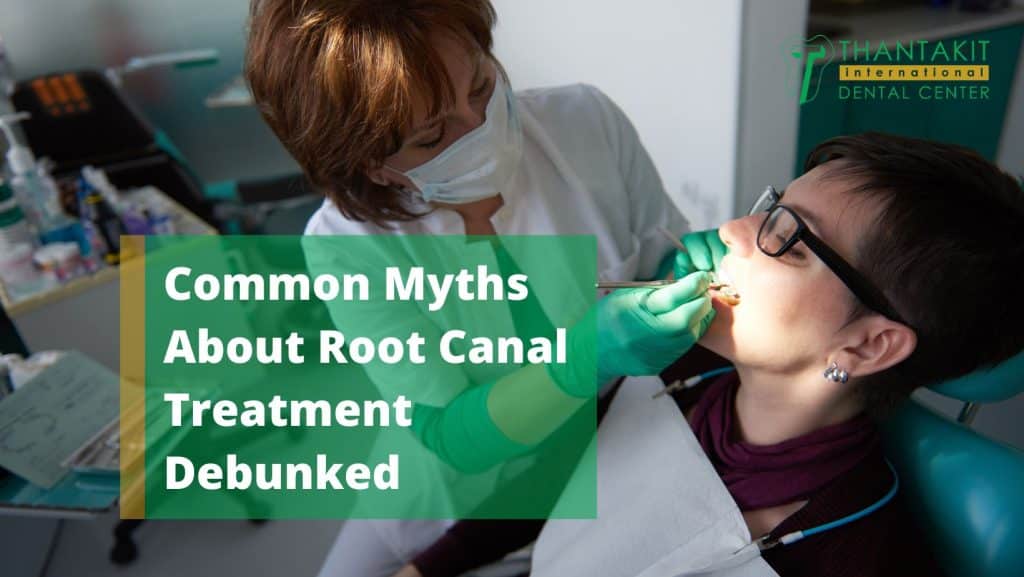 Common Myths About Root Canal Treatment Debunked