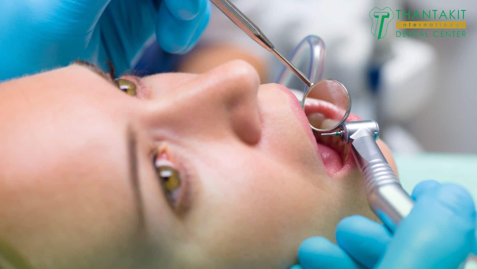 Why Gum Health Matters So Much for Diabetic Patients