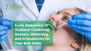 Smile Makeovers in Thailand Combining Veneers, Whitening, and Orthodontics for Your Best Smile