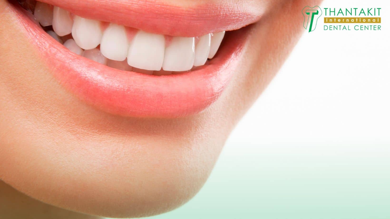 What a Smile Makeover Includes