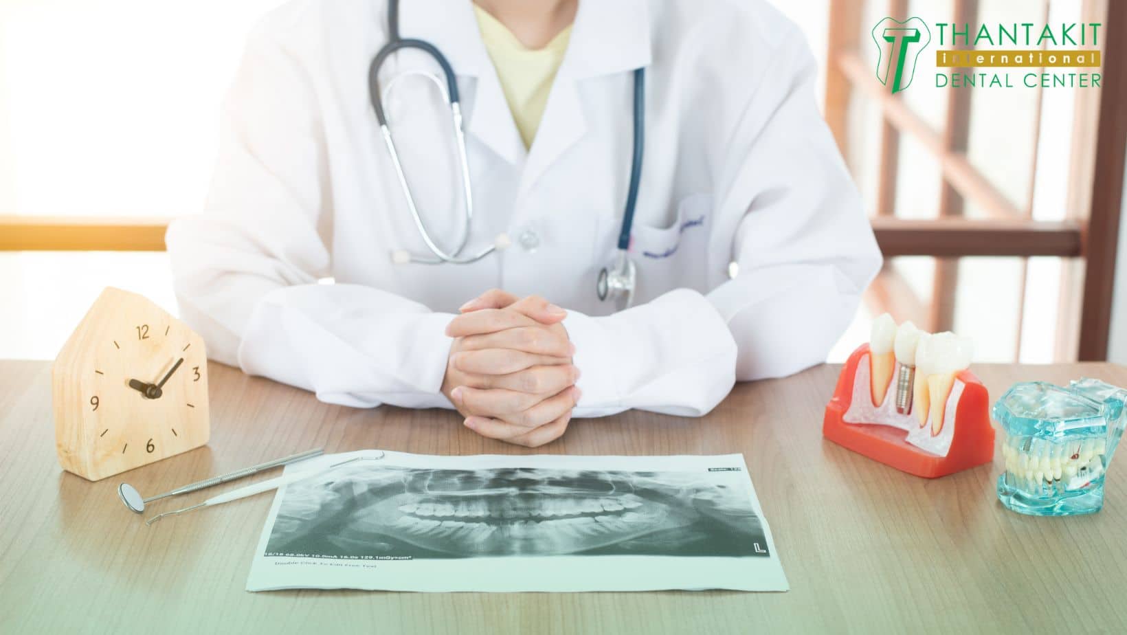 Common Dental Injuries in Sports