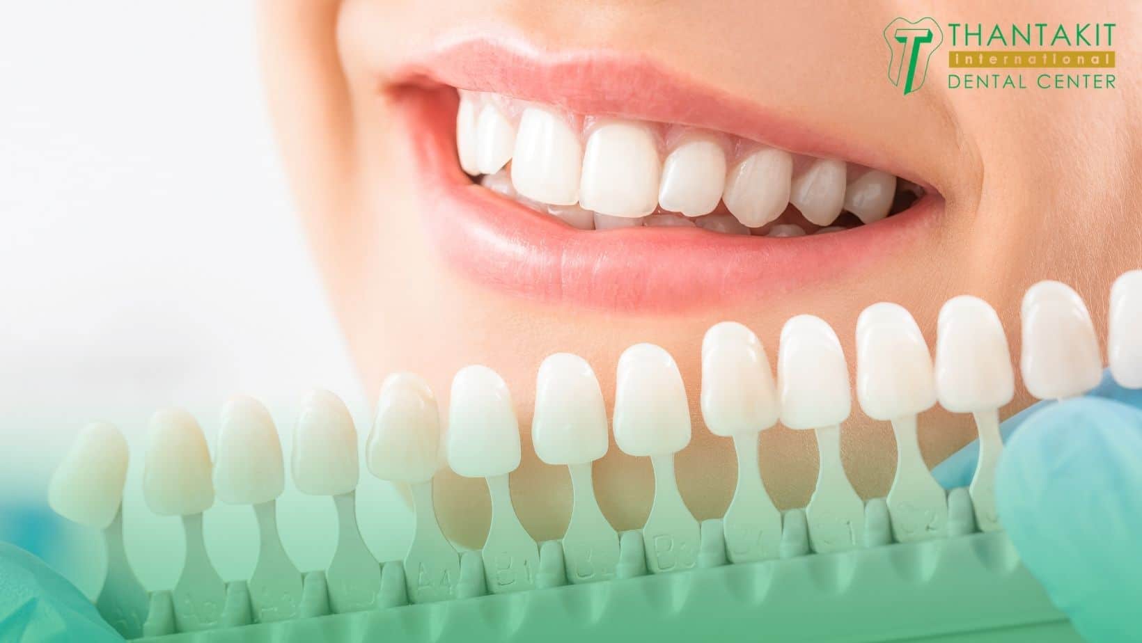 Professional Whitening When It Makes Sense