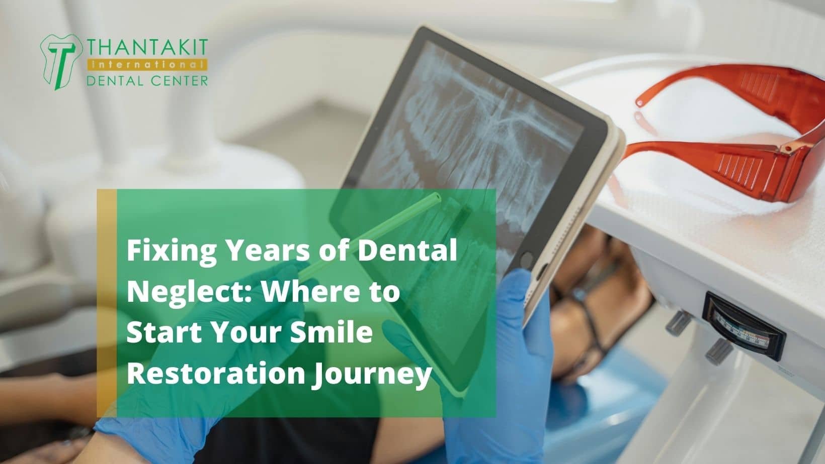 Fixing Years of Dental Neglect Where to Start Your Smile Restoration Journey