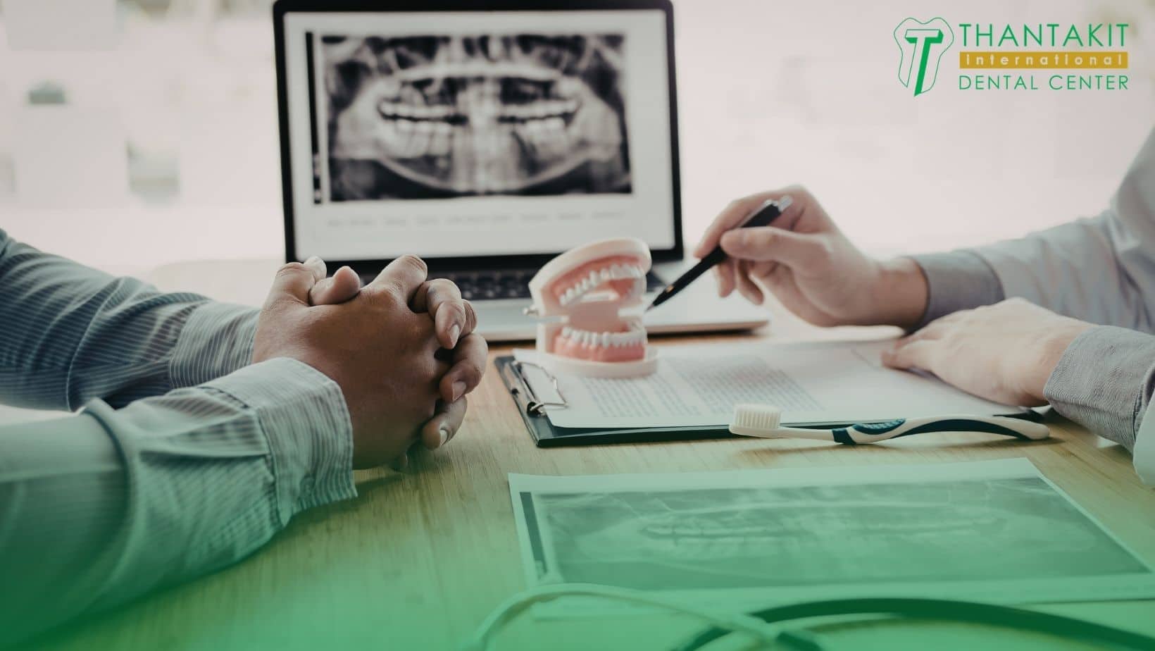 Step 4 Full Mouth Reconstruction for Severe Cases