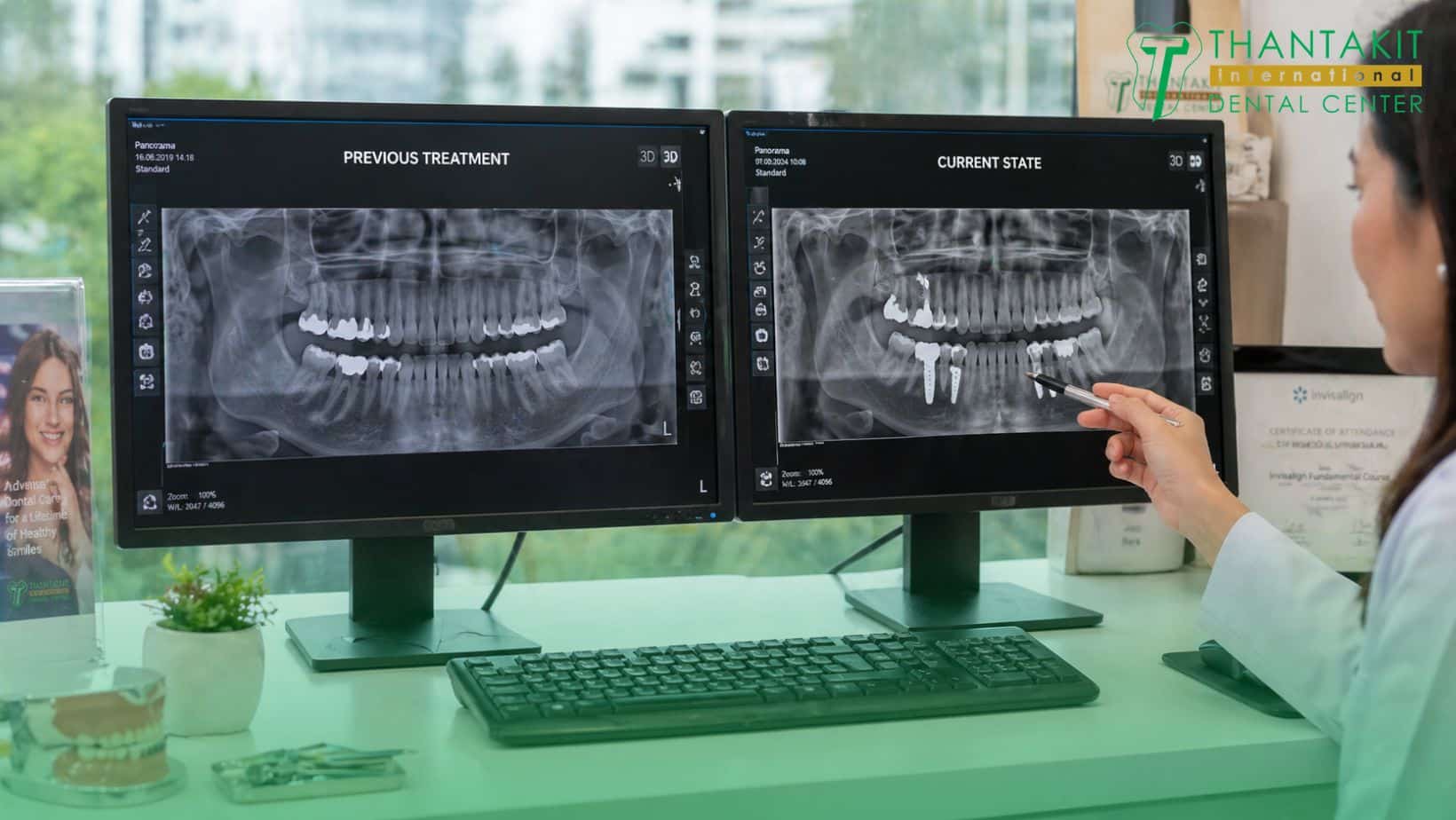 Get a Professional Evaluation at Thantakit