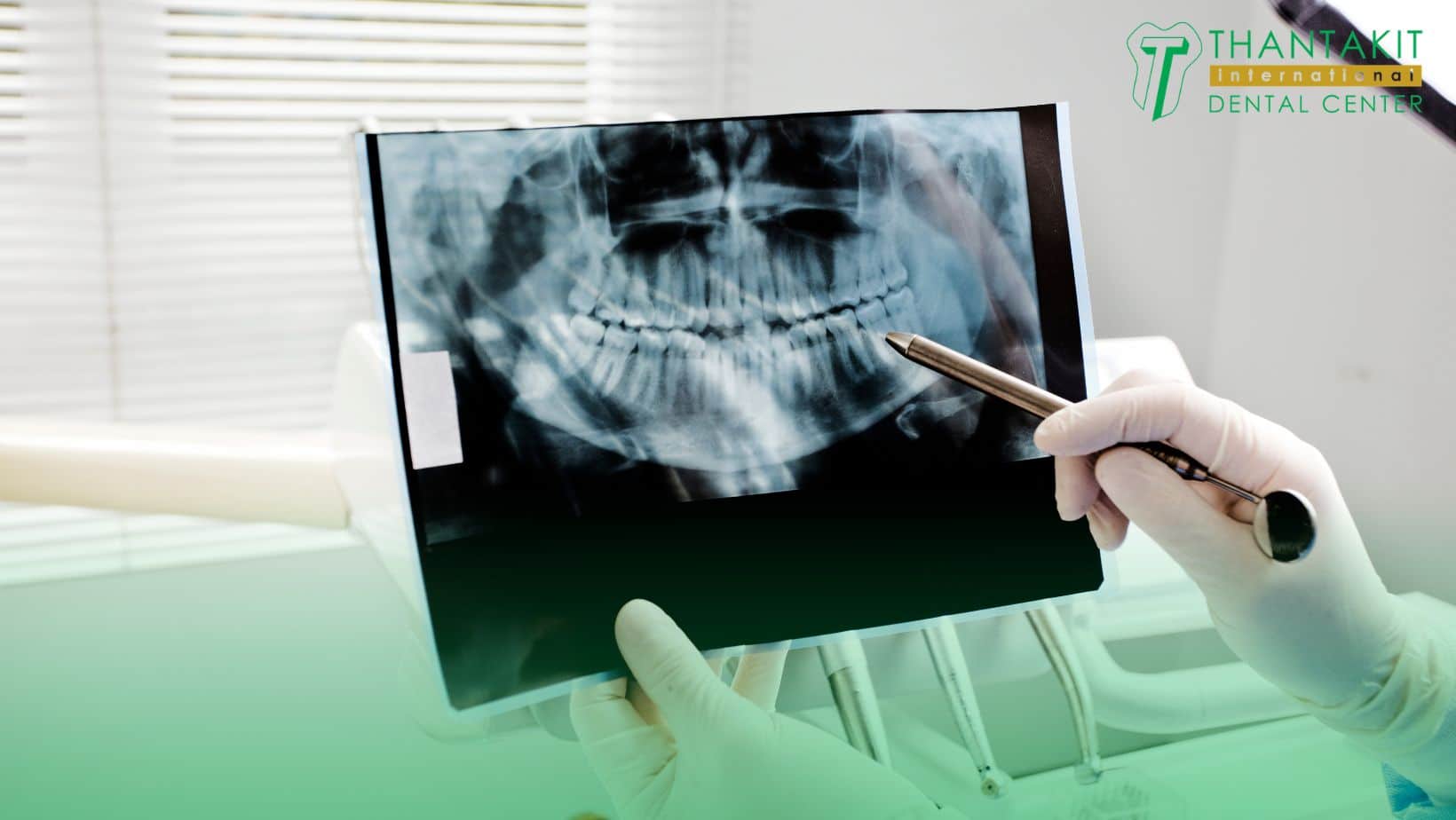 How Often Do You Need Dental Imaging