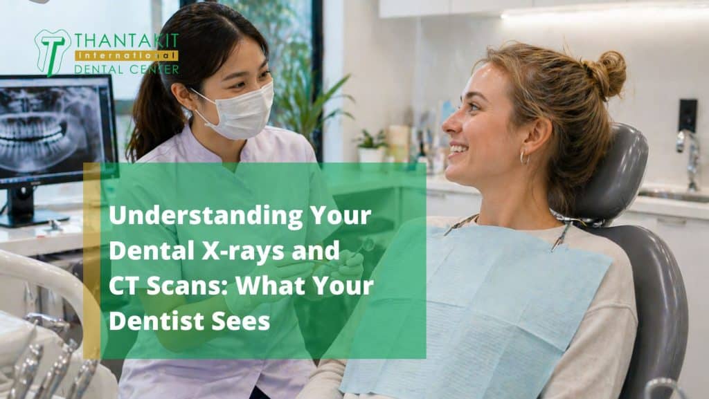 Understanding Your Dental X-rays and CT Scans What Your Dentist Sees