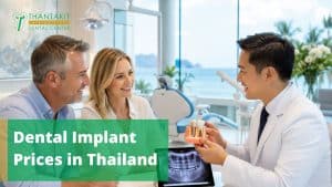Dental_Implant_Prices_in_Thailand